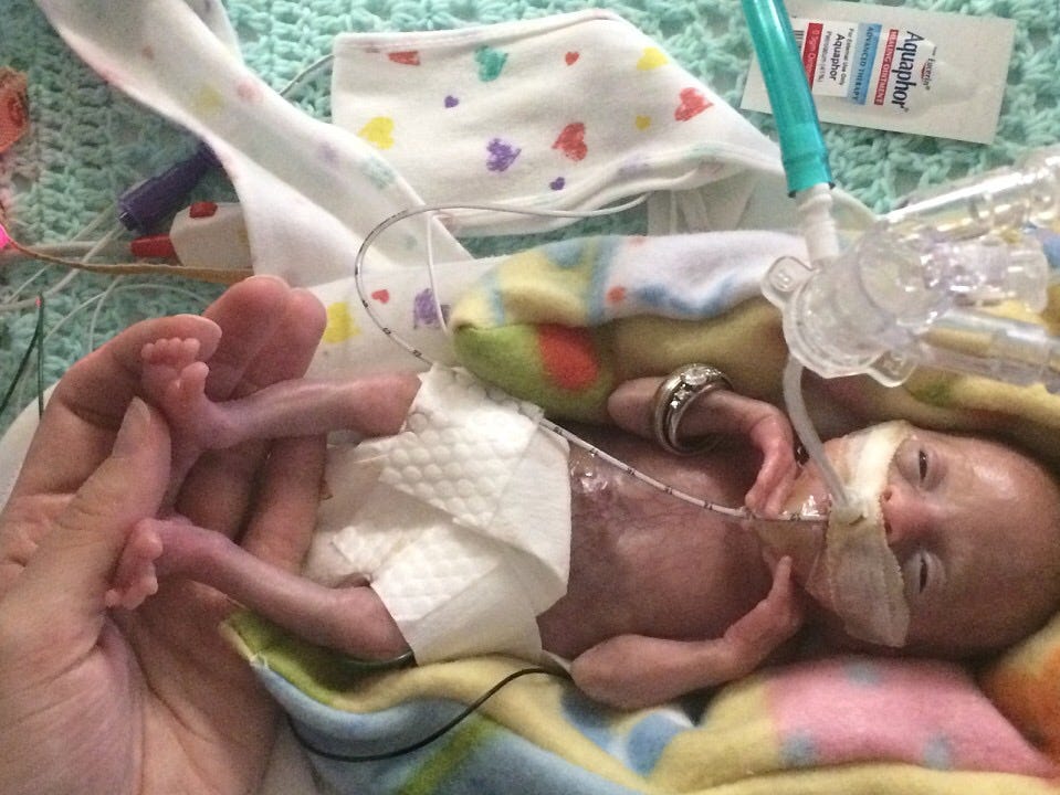 premature baby birth